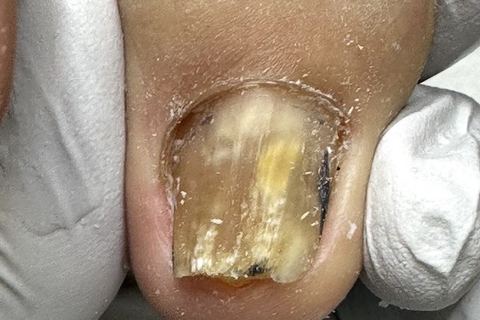 Berg Healthy Feet & Nails